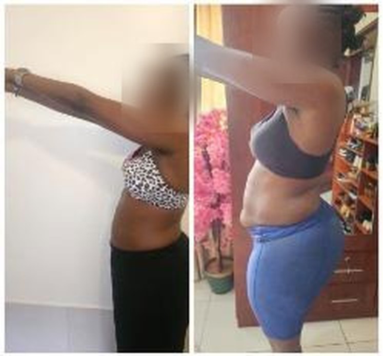 Nada before and after, side view, face hidden for privacy
